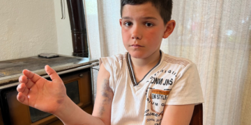 9 vjeçari nga Shkodra: Ëndrra më e madhe është të shërohem