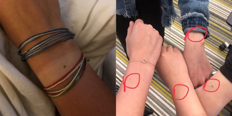 Mijëra gra kanë një njollë ‘identike’ në të njëjtin vend. Po ju keni një të tillë?