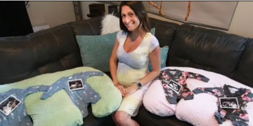 Ndodh “1 në 70 milion”, 35-vjeçarja shtatzënë me dy çifte binjakësh identikë