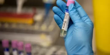 Spanjë/Regjistrohet viktima e dytë me linë e majmunëve