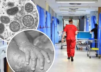 Infektohet me linë e majmunëve shqiptari në Thesali