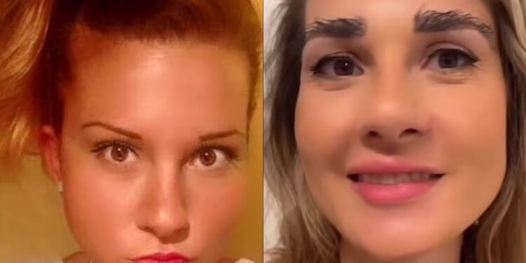 Nuk ishte e kënaqur me pamjen e saj, 36-vjeçarja bën transplant vetullash me qimet e marra nga koka (VIDEO)