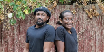 Binjakët e parë të bashkuar që janë ndarë, zbulojnë lidhjen pothuajse të mbinatyrshme