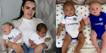 29-vjeçarja sjell në jetë binjakët me ngjyrë të ndryshme (FOTO)