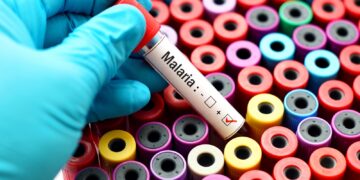 Shkencëtarët: Vaksina e re e malaries po ndryshon botën