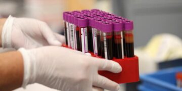 Një test i ri gjaku zbulon mbi 50 lloje kanceri