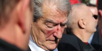 31-vjeçari që goditi Berishën vuante nga sëmundje mendore! Ish-kryeministri: Lirojeni fatkeqin, është i shitur te Rama