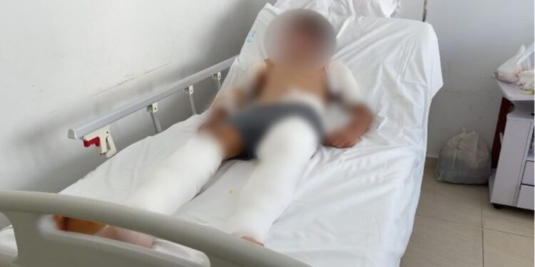 Po ruante delet i vetëm, detaje nga ngjarja e rëndë në Delvinë, 12-vjeçari i fashuar nga koka te këmbët, u sulmua nga 6 qentë e kopesë tjetër