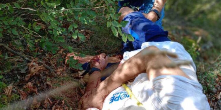 E rëndë në Greqi, burri sulmohet nga ariu, në tentativë për t’i shpëtuar bie në greminë