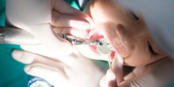 Vdekja e 3-vjeçarit pas ndërhyrjes kirurgjikale, Urdhri i Stomatologëve: Kërkojmë të gjitha të dhënat e mjekimit dhe proceset e ndjekura nga dentisti ndaj të miturit