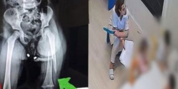 Dhuna ndaj 3-vjeçares në kopsht, rimerret në pyetje edukatorja: Vajza u vra vetë te hapësirat e krevatit