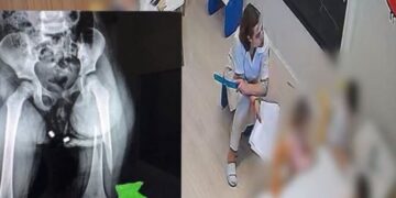 Dyshohet se 3-vjeçares iu thye këmba nga dhuna në kopsht, qytetarët njoftojnë lëvizjen urgjente