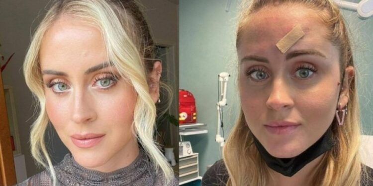 Shenja delikate që çoi në zbulimin e kancerit të modeles italiane në moshën 30-vjeçare