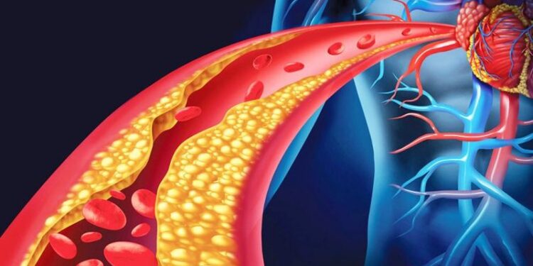 Mësoni një mënyrë të thjeshtë dhe natyrale për të pastruar enët e gjakut