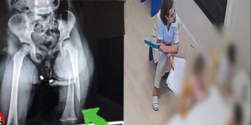 Dhunoi barbarisht 3-vjeçaren në kopshtin privat, arrestohet edukatorja