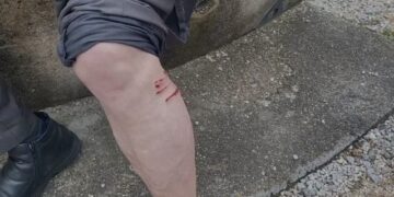 Qentë endacakë shqetësim në Lezhë, sulmojnë qytetarin