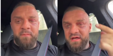 I nxirë dhe me plagë në fytyrë, Medi Iseni publikon video për herë të parë pas sherrit me Noizy-n