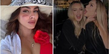 Goditën me shishe qelqi Klea Prengën në fytyrë, merret vendimi për motrat Berisha