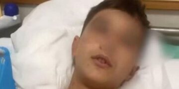 “Ka dhimbje në zemër”, babai i Luisit zbulon gjendjen e djalit dhe nëse ka negociata me familjen e autorit: S’kanë kërkuar falje