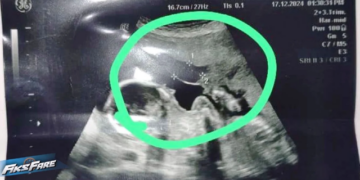 “Më qëlloi 2 foshnjat në bark, autori i lirë”, denoncimi i 33-vjeçares: Ngjarja brenda gjykatës!