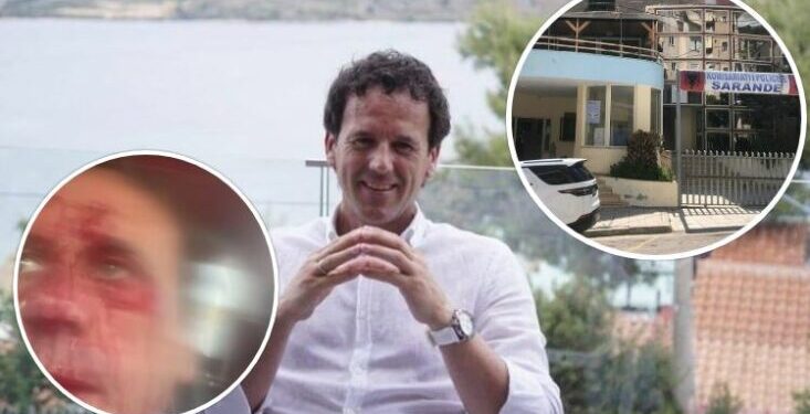 U dhunua brutalisht, kreu i Operatorëve Turistik i Sarandës flet i gjakosur pas konfliktit