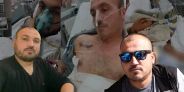 U plagos nga i dashuri i bashkëshortes, 40-vjeçari në gjendje të rëndë, familja apel për ndihmë: Nuk po i përballojmë dot më shpenzimet!