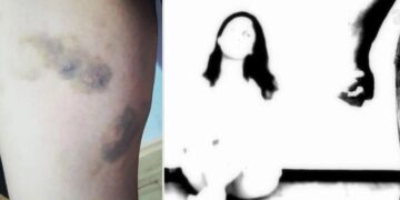 “Nga dhuna e burrit humba fëmijën”, nëna e dy të miturve kërkon drejtësi