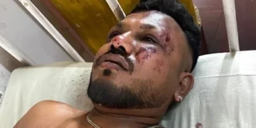 FOTO/ I mbijetuari i vetëm: “Dëgjova zhurma të mëdha, trupa rreth meje”