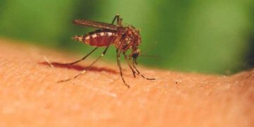 Kujdes nga pickimet! Mjekja tregon çfarë duhet të dini