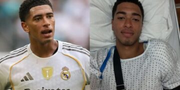 Plan special rikuperimi, data se kur do të rikthehet Jude Bellingham pas operacionit në shpatull