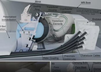 Një helmetë me ultratinguj do të ndalojë dridhjet e Parkinsonit