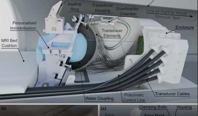 Një helmetë me ultratinguj do të ndalojë dridhjet e Parkinsonit