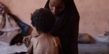 13 persona humbën jetën nga uria në Gaza 24 orët e fundit, mes tyre 3 të mitur