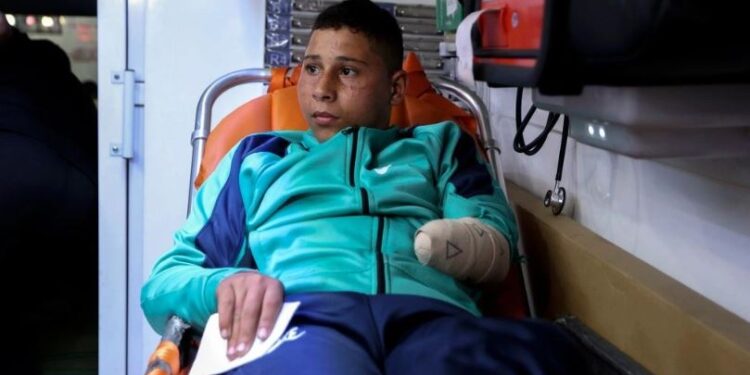 Shkak lëndimet nga lufta 2-vjeçare në Gaza, të paktën 21 mijë fëmijë palestinezë jetojnë me aftësi të kufizuara