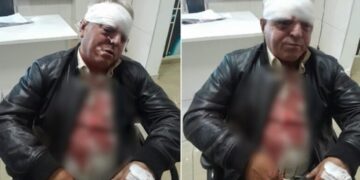 Dhunuan barbarisht punonjësin e pastrimit në Vlorë, arrestohen dy autorët