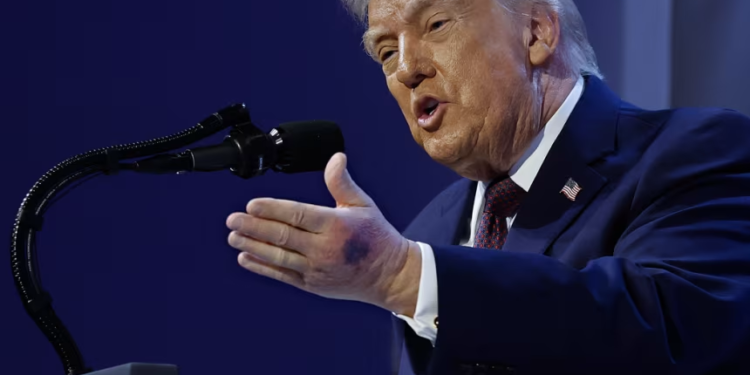 Trump shpjegon mavijosjen në dorën e majtë: Më ra…