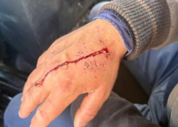 Tensione në Rrjoll,6 persona shoqërohen në polici. Lëndohet një prej protestuesve 26 Shkurt, 2026