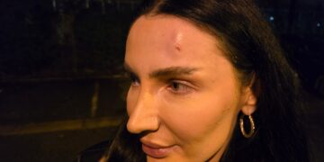 Përplasje mes protestuesve dhe policisë, ish-kandidatja për deputete e PD lëndohet në kokë